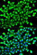 Immunofluorescence analysis of MCF-7 cells using PHD2/EGLN1 antibody (STJ116175). Blue: DAPI for nuclear staining.
