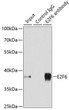 Immunoprecipitation analysis of 200 Mu g extracts of MCF-7 cells using 3 Mu g E2F6 antibody (STJ116186). Western blot was performed from the immunoprecipitate using E2F6 antibody (STJ116186) at a dilution of 1:500. Immunoprecipitation analysis of 200 Mu g extracts of MCF-7 cells using 3 Mu g E2F6 antibody (STJ116186). Western blot was performed from the immunoprecipitate using E2F6 antibody (STJ116186) at a dilution of 1:500.