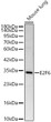 Western blot analysis of lysates from Mouse lung using E2F6 Rabbit polyclonal antibody (STJ116186) at 1:1000 dilution. Secondary antibody:HRP Goat Anti-Rabbit IgG (H+L) (STJS000856) at 1:10000 dilution. Lysates/proteins: 25  Mu g per lane. Blocking buffer: 3% nonfat dry milk in TBST. Detection:ECL Basic Kit. Exposuretime:180s. Western blot analysis of lysates from Mouse lung using E2F6 Rabbit polyclonal antibody (STJ116186) at 1:1000 dilution. Secondary antibody:HRP Goat Anti-Rabbit IgG (H+L) (STJS000856) at 1:10000 dilution. Lysates/proteins: 25  Mu g per lane. Blocking buffer: 3% nonfat dry milk in TBST. Detection:ECL Basic Kit. Exposuretime:180s.