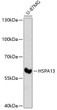Western blot analysis of lysates from U-87MG cells, using HSPA13 Rabbit pAb (STJ116234) at 1:3000 dilution. <br/>Secondary antibody: HRP-conjugated Goat anti-Rabbit IgG (H+L) (STJS000856) at 1:10000 dilution. <br/>Lysates/proteins: 25 Mu g per lane. <br/>Blocking buffer: 3% nonfat dry milk in TBST. <br/>Detection: ECL Enhanced Kit <br/>Exposure time: 90s. Western blot analysis of lysates from U-87MG cells, using HSPA13 Rabbit pAb (STJ116234) at 1:3000 dilution. <br/>Secondary antibody: HRP-conjugated Goat anti-Rabbit IgG (H+L) (STJS000856) at 1:10000 dilution. <br/>Lysates/proteins: 25 Mu g per lane. <br/>Blocking buffer: 3% nonfat dry milk in TBST. <br/>Detection: ECL Enhanced Kit <br/>Exposure time: 90s.