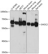 Western blot analysis of various lysates using SHOC2 Rabbit polyclonal antibody (STJ116236) at 1:3000 dilution. Secondary antibody: HRP Goat Anti-Rabbit IgG (H+L) (STJS000856) at 1:10000 dilution. Lysates/proteins: 25 Mu g per lane. Blocking buffer: 3% nonfat dry milk in TBST. Detection: ECL Basic Kit. Exposure time: 10s.