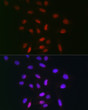 Immunofluorescence analysis of U-2 OS cells using TDP1 Rabbit polyclonal antibody (STJ116265) at dilution of 1:100 (40x lens). Blue: DAPI for nuclear staining.