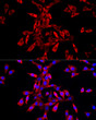 Immunofluorescence analysis of NIH/3T3 cells using IGF2BP3 rabbit polyclonal antibody (STJ116296) at dilution of 1:50 (40x lens). Blue: DAPI for nuclear staining.
