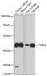 Western blot analysis of various lysates using TOM1 Rabbit pAb (STJ116355) at 1:3000 dilution. <br/>Secondary antibody: HRP-conjugated Goat anti-Rabbit IgG (H+L) (STJS000856) at 1:10000 dilution. <br/>Lysates/proteins: 25 Mu g per lane. <br/>Blocking buffer: 3% nonfat dry milk in TBST. <br/>Detection: ECL Basic Kit <br/>Exposure time: 90s.