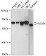 Western blot analysis of various lysates using DDX56 Rabbit pAb (STJ116360) at 1:3000 dilution. <br/>Secondary antibody: HRP-conjugated Goat anti-Rabbit IgG (H+L) (STJS000856) at 1:10000 dilution. <br/>Lysates/proteins: 25 Mu g per lane. <br/>Blocking buffer: 3% nonfat dry milk in TBST. <br/>Detection: ECL Basic Kit <br/>Exposure time: 1s.