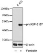 Western blot analysis of lysates from HEL cells using Phospho-VASP-S157 Rabbit pAb (STJ116383) at 1:1000 dilution. HEL cells were treated by Forskolin (20 uM) at 37 °C for 1 hour. <br/>Secondary antibody: HRP-conjugated Goat anti-Rabbit IgG (H+L) (STJS000856) at 1:10000 dilution. <br/>Lysates/proteins: 25  Mu g per lane. <br/>Blocking buffer: 3% nonfat dry milk in TBST. <br/>Detection: ECL Basic Kit <br/>Exposure time: 0. 8s.