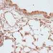Immunohistochemistry analysis of paraffin-embedded Mouse lung using Phospho-VASP-S157 Rabbit pAb (STJ116383) at dilution of 1:100 (40x lens). Microwave antigen retrieval performed with 0. 01M Tris/EDTA Buffer (pH 9. 0) prior to immunohistochemistry staining.
