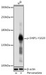 Western blot analysis of lysates from Raji cells, using Phospho-SHIP1-Y1020 Rabbit pAb (STJ116398) at 1:1000 dilution. Raji cells were treated by Pervanadate (1 mM) at 37 °C for 30 minutes. <br/>Secondary antibody: HRP-conjugated Goat anti-Rabbit IgG (H+L) (STJS000856) at 1:10000 dilution. <br/>Lysates/proteins: 25 Mu g per lane. <br/>Blocking buffer: 3% nonfat dry milk in TBST. <br/>Detection: ECL Basic Kit <br/>Exposure time: 1s.