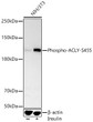 Western blot analysis of lysates from NIH/3T3 cells using Phospho-ACLY-S455 Rabbit pAb (STJ116399) at 1:400 dilution. NIH/3T3 cells were treated by Insulin (200 nM) at 37 °C for 30 minutes after serum-starvation overnight. <br/>Secondary antibody: HRP-conjugated Goat anti-Rabbit IgG (H+L) (STJS000856) at 1:10000 dilution. <br/>Lysates/proteins: 25  Mu g per lane. <br/>Blocking buffer: 3% nonfat dry milk in TBST. <br/>Detection: ECL Basic Kit <br/>Exposure time: 60s.