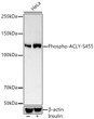 Western blot analysis of lysates from HeLa cells using Phospho-ACLY-S455 Rabbit pAb (STJ116399) at 1:400 dilution. HeLa cells were treated by Insulin (50 nM) at 37 °C for 30 minutes after serum-starvation overnight. <br/>Secondary antibody: HRP-conjugated Goat anti-Rabbit IgG (H+L) (STJS000856) at 1:10000 dilution. <br/>Lysates/proteins: 25  Mu g per lane. <br/>Blocking buffer: 3% nonfat dry milk in TBST. <br/>Detection: ECL Basic Kit <br/>Exposure time: 60s.