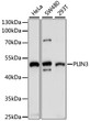 Western blot analysis of various lysates using PLIN3 Rabbit polyclonal antibody (STJ116409) at 1:1000 dilution. Secondary antibody: HRP Goat Anti-Rabbit IgG (H+L) (STJS000856) at 1:10000 dilution. Lysates/proteins: 25 Mu g per lane. Blocking buffer: 3% nonfat dry milk in TBST. Detection: ECL Enhanced Kit. Exposure time: 30s.