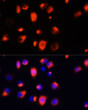 Immunofluorescence analysis of HeLa cells using Heme Oxygenase 1 (HO-1/HMOX1) antibody (STJ116419) at dilution of 1:100 (40x lens). Blue: DAPI for nuclear staining.