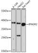 Western blot analysis of extracts of various cell lines, using IFNGR2 Rabbit polyclonal antibody (STJ116437) at 1:1000 dilution. Secondary antibody: HRP Goat Anti-Rabbit IgG (H+L) (STJS000856) at 1:10000 dilution. Lysates/proteins: 25 Mu g per lane. Blocking buffer: 3% nonfat dry milk in TBST. Detection: ECL Enhanced Kit. Exposure time: 90s.