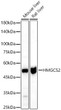 Immunohistochemistry analysis of paraffin-embedded human thyroid cancer using HMGCS2 antibody (STJ116457) at dilution of 1:100 (40x lens). Perform microwave antigen retrieval with 10 mM PBS buffer pH 7. 2 before commencing with immunohistochemistry staining protocol.