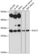Western blot analysis of various lysates using KLK13 Rabbit pAb (STJ116486) at 1:3000 dilution. <br/>Secondary antibody: HRP-conjugated Goat anti-Rabbit IgG (H+L) (STJS000856) at 1:10000 dilution. <br/>Lysates/proteins: 25 Mu g per lane. <br/>Blocking buffer: 3% nonfat dry milk in TBST. <br/>Detection: ECL Enhanced Kit <br/>Exposure time: 90s.