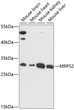 Western blot analysis of various lysates using MRPS2 Rabbit polyclonal antibody (STJ116491) at 1:3000 dilution. Secondary antibody: HRP Goat Anti-Rabbit IgG (H+L) (STJS000856) at 1:10000 dilution. Lysates/proteins: 25 Mu g per lane. Blocking buffer: 3% nonfat dry milk in TBST. Detection: ECL Basic Kit. Exposure time: 90s.