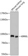 Western blot analysis of various lysates using KIRREL Rabbit polyclonal antibody (STJ116495) at 1:1000 dilution. Secondary antibody: HRP Goat Anti-Rabbit IgG (H+L) (STJS000856) at 1:10000 dilution. Lysates/proteins: 25 Mu g per lane. Blocking buffer: 3% nonfat dry milk in TBST. Detection: ECL Basic Kit. Exposure time: 30s.