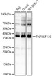 Western blot analysis of various lysates, using TNFRSF13C Rabbit polyclonal antibody (STJ116511) at 1:400 dilution. Secondary antibody: HRP Goat Anti-Rabbit IgG (H+L) (STJS000856) at 1:10000 dilution. Lysates/proteins: 25 Mu g per lane. Blocking buffer: 3% nonfat dry milk in TBST. Detection: ECL Enhanced Kit. Exposure time: 180s.
