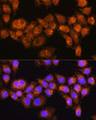 Immunofluorescence analysis of HeLa cells using RABL3 Rabbit polyclonal antibody (STJ116539) at dilution of 1:100. Secondary antibody: Cy3 Goat Anti-Rabbit IgG (H+L) at 1:500 dilution. Blue: DAPI for nuclear staining. Immunofluorescence analysis of HeLa cells using RABL3 Rabbit polyclonal antibody (STJ116539) at dilution of 1:100. Secondary antibody: Cy3 Goat Anti-Rabbit IgG (H+L) at 1:500 dilution. Blue: DAPI for nuclear staining.
