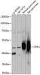 Western blot analysis of various lysates using CPA2 Rabbit pAb (STJ116585) at 1:3000 dilution. <br/>Secondary antibody: HRP-conjugated Goat anti-Rabbit IgG (H+L) (STJS000856) at 1:10000 dilution. <br/>Lysates/proteins: 25 Mu g per lane. <br/>Blocking buffer: 3% nonfat dry milk in TBST. <br/>Detection: ECL Basic Kit <br/>Exposure time: 15s.