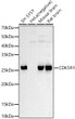 Western blot analysis of various lysates, using CDK5R1 antibody (STJ116708) at 1:700 dilution. Secondary antibody: HRP Goat Anti-Rabbit IgG (H+L) (STJS000856) at 1:10000 dilution. Lysates/proteins: 25 Mu g per lane. Blocking buffer: 3% nonfat dry milk in TBST. Detection: ECL Basic Kit. Exposure time: 30s.