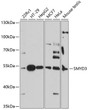 Western blot analysis of various lysates using SMYD3 Rabbit polyclonal antibody (STJ116727) at 1:3000 dilution. Secondary antibody: HRP Goat Anti-Rabbit IgG (H+L) (STJS000856) at 1:10000 dilution. Lysates/proteins: 25 Mu g per lane. Blocking buffer: 3% nonfat dry milk in TBST. Detection: ECL Basic Kit. Exposure time: 90s.