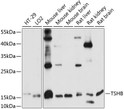Western blot analysis of various lysates using TSHB Rabbit polyclonal antibody (STJ116734) at 1:1000 dilution. Secondary antibody: HRP Goat Anti-Rabbit IgG (H+L) (STJS000856) at 1:10000 dilution. Lysates/proteins: 25 Mu g per lane. Blocking buffer: 3% nonfat dry milk in TBST. Detection: ECL Basic Kit. Exposure time: 10s.
