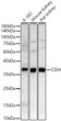 Western blot analysis of various lysates, using CISH Rabbit polyclonal antibody (STJ116738) at 1:2000 dilution. Secondary antibody: HRP Goat Anti-Rabbit IgG (H+L) (STJS000856) at 1:10000 dilution. Lysates/proteins: 25 Mu g per lane. Blocking buffer: 3% nonfat dry milk in TBST. Detection: ECL Basic Kit. Exposure time: 90s.