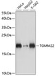 Western blot analysis of various lysates using TOMM22 Rabbit polyclonal antibody (STJ116759) at 1:3000 dilution. Secondary antibody: HRP Goat Anti-Rabbit IgG (H+L) (STJS000856) at 1:10000 dilution. Lysates/proteins: 25 Mu g per lane. Blocking buffer: 3% nonfat dry milk in TBST. Detection: ECL Basic Kit. Exposure time: 10s.