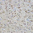 Immunohistochemistry analysis of CRMP2/DPYSL2 in paraffin-embedded mouse brain using [KO Validated] CRMP2/CRMP2/DPYSL2 Rabbit polyclonal antibody (STJ116781) at dilution of 1:400 (40x lens). Perform high pressure antigen retrieval with 10 mM citrate buffer pH 6. 0 before commencing with immunohistochemistry staining protocol.