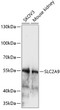 Western blot analysis of various lysates using SLC2A9 Rabbit pAb (STJ116802) at 1:1000 dilution. <br/>Secondary antibody: HRP-conjugated Goat anti-Rabbit IgG (H+L) (STJS000856) at 1:10000 dilution. <br/>Lysates/proteins: 25 Mu g per lane. <br/>Blocking buffer: 3% nonfat dry milk in TBST. <br/>Detection: ECL Enhanced Kit <br/>Exposure time: 6min.