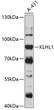 Western blot analysis of lysates from A-431 cells, using KLHL1 Rabbit polyclonal antibody (STJ116804) at 1:1000 dilution. Secondary antibody: HRP Goat Anti-Rabbit IgG (H+L) (STJS000856) at 1:10000 dilution. Lysates/proteins: 25 Mu g per lane. Blocking buffer: 3% nonfat dry milk in TBST. Detection: ECL Basic Kit. Exposure time: 30s.