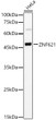 Western blot analysis of HeLa, using ZNF621 Rabbit polyclonal antibody (STJ116841) at 1:600 dilution. Secondary antibody: HRP Goat Anti-Rabbit IgG (H+L) (STJS000856) at 1:10000 dilution. Lysates/proteins: 25 Mu g per lane. Blocking buffer: 3% nonfat dry milk in TBST. Detection: ECL Basic Kit. Exposure time: 60s.