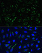 Immunofluorescence analysis of U-2 OS cells using IDH3A Rabbit polyclonal antibody (STJ116856) at dilution of 1:100. Secondary antibody: Cy3 Goat Anti-Rabbit IgG (H+L) at 1:500 dilution. Blue: DAPI for nuclear staining.