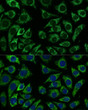 Immunofluorescence analysis of L929 cells using IDH3A Rabbit polyclonal antibody (STJ116856) at dilution of 1:100. Secondary antibody: Cy3 Goat Anti-Rabbit IgG (H+L) at 1:500 dilution. Blue: DAPI for nuclear staining.