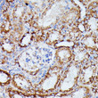 Immunohistochemistry analysis of IDH3A in paraffin-embedded mouse kidney using IDH3A Rabbit polyclonal antibody (STJ116856) at dilution of 1:100 (40x lens). Perform microwave antigen retrieval with 10 mM PBS buffer pH 7. 2 before commencing with immunohistochemistry staining protocol.