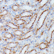 Immunohistochemistry analysis of IDH3A in paraffin-embedded rat kidney using IDH3A Rabbit polyclonal antibody (STJ116856) at dilution of 1:100 (40x lens). Perform microwave antigen retrieval with 10 mM PBS buffer pH 7. 2 before commencing with immunohistochemistry staining protocol.