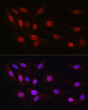 Immunofluorescence analysis of NIH/3T3 cells using SP1 Rabbit polyclonal antibody (STJ116866) at dilution of 1:50 (40x lens). Blue: DAPI for nuclear staining.