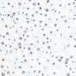 Immunohistochemistry analysis of paraffin-embedded rat liver using SP1 Rabbit polyclonal antibody (STJ116866) at dilution of 1:50 (40x lens). Perform high pressure antigen retrieval with 10 mM citrate buffer pH 6. 0 before commencing with immunohistochemistry staining protocol.