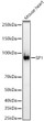 Western blot analysis of Mouse heart, using SP1 antibody (STJ116866) at 1:600 dilution. Secondary antibody: HRP Goat Anti-Rabbit IgG (H+L) (STJS000856) at 1:10000 dilution. Lysates/proteins: 25 Mu g per lane. Blocking buffer: 3% nonfat dry milk in TBST. Detection: ECL Basic Kit. Exposure time: 30s.