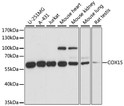 Western blot analysis of various lysates using COX15 Rabbit polyclonal antibody (STJ116869) at 1:1000 dilution. Secondary antibody: HRP Goat Anti-Rabbit IgG (H+L) (STJS000856) at 1:10000 dilution. Lysates/proteins: 25 Mu g per lane. Blocking buffer: 3% nonfat dry milk in TBST. Detection: ECL Basic Kit. Exposure time: 5s.