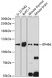 Western blot analysis of various lysates using EPHB6 Rabbit polyclonal antibody (STJ116928) at 1:1000 dilution. Secondary antibody: HRP Goat Anti-Rabbit IgG (H+L) (STJS000856) at 1:10000 dilution. Lysates/proteins: 25 Mu g per lane. Blocking buffer: 3% nonfat dry milk in TBST. Detection: ECL Enhanced Kit. Exposure time: 30s.