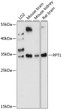 Western blot analysis of various lysates using PPT1 Rabbit polyclonal antibody (STJ116969) at 1:1000 dilution. Secondary antibody: HRP Goat Anti-Rabbit IgG (H+L) (STJS000856) at 1:10000 dilution. Lysates/proteins: 25 Mu g per lane. Blocking buffer: 3% nonfat dry milk in TBST. Detection: ECL Basic Kit. Exposure time: 30s.