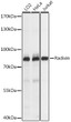 Western blot analysis of various lysates using Radixin Rabbit polyclonal antibody (STJ116977) at 1:1000 dilution. Secondary antibody: HRP Goat Anti-Rabbit IgG (H+L) (STJS000856) at 1:10000 dilution. Lysates/proteins: 25 Mu g per lane. Blocking buffer: 3% nonfat dry milk in TBST. Detection: ECL Basic Kit. Exposure time: 1s. Western blot analysis of various lysates using Radixin Rabbit polyclonal antibody (STJ116977) at 1:1000 dilution. Secondary antibody: HRP Goat Anti-Rabbit IgG (H+L) (STJS000856) at 1:10000 dilution. Lysates/proteins: 25 Mu g per lane. Blocking buffer: 3% nonfat dry milk in TBST. Detection: ECL Basic Kit. Exposure time: 1s.