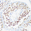 Immunohistochemistry analysis of paraffin-embedded mouse testis using DDX21 antibody (STJ117020) at dilution of 1:100 (40x lens). Perform microwave antigen retrieval with 10 mM PBS buffer pH 7. 2 before commencing with immunohistochemistry staining protocol.