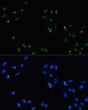 Immunofluorescence analysis of U-2 OS cells using DDX21 antibody (STJ117020) at dilution of 1:100. Blue: DAPI for nuclear staining.