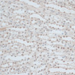 Immunohistochemistry analysis of ZNF562 in paraffin-embedded mouse kidney using ZNF562 Rabbit polyclonal antibody (STJ117101) at dilution of 1:100 (40x lens). Perform microwave antigen retrieval with 10 mM PBS buffer pH 7. 2 before commencing with immunohistochemistry staining protocol. Immunohistochemistry analysis of ZNF562 in paraffin-embedded mouse kidney using ZNF562 Rabbit polyclonal antibody (STJ117101) at dilution of 1:100 (40x lens). Perform microwave antigen retrieval with 10 mM PBS buffer pH 7. 2 before commencing with immunohistochemistry staining protocol.