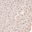 Immunohistochemistry analysis of ZNF562 in paraffin-embedded mouse liver using ZNF562 Rabbit polyclonal antibody (STJ117101) at dilution of 1:100 (40x lens). Perform microwave antigen retrieval with 10 mM PBS buffer pH 7. 2 before commencing with immunohistochemistry staining protocol. Immunohistochemistry analysis of ZNF562 in paraffin-embedded mouse liver using ZNF562 Rabbit polyclonal antibody (STJ117101) at dilution of 1:100 (40x lens). Perform microwave antigen retrieval with 10 mM PBS buffer pH 7. 2 before commencing with immunohistochemistry staining protocol.
