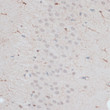 Immunohistochemistry analysis of paraffin-embedded Mouse brain using ZNF415 Rabbit pAb (STJ117113) at dilution of 1:100 (40x lens). Microwave antigen retrieval performed with 0. 01M PBS Buffer (pH 7. 2) prior to immunohistochemistry staining.