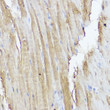 Immunohistochemistry analysis of paraffin-embedded mouse heart using STAT2 Rabbit polyclonal antibody (STJ117193) at dilution of 1:50 (40x lens). Perform high pressure antigen retrieval with 10 mM citrate buffer pH 6. 0 before commencing with immunohistochemistry staining protocol.